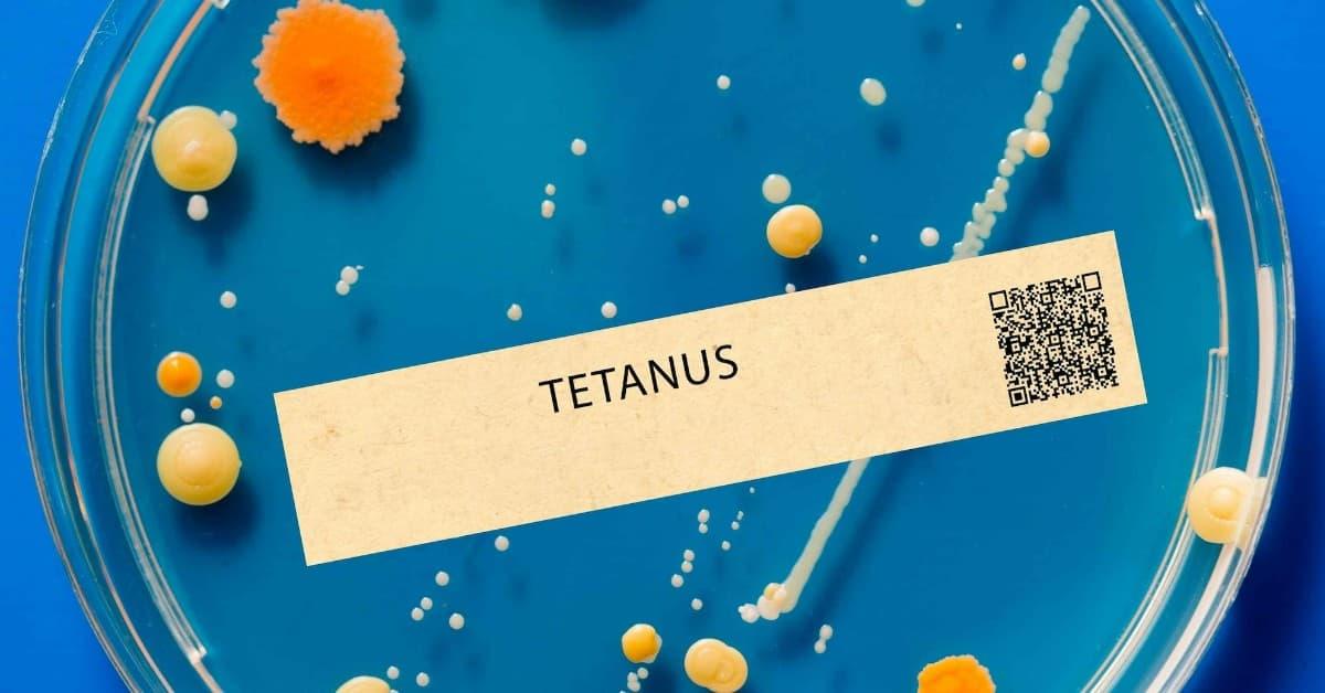 Clostridium Tetani, the Causative Agent of Tetanus