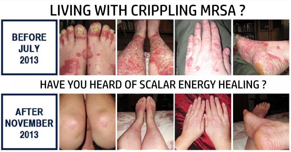 MSRA before and after Scalar Light