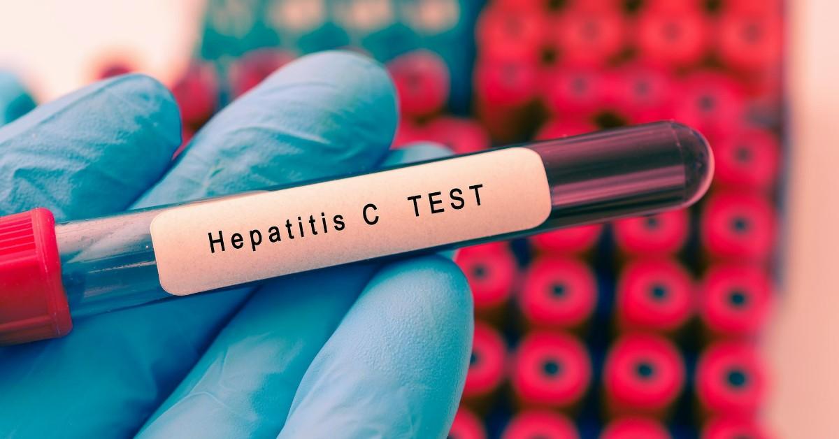Hepatitis C PCR Test