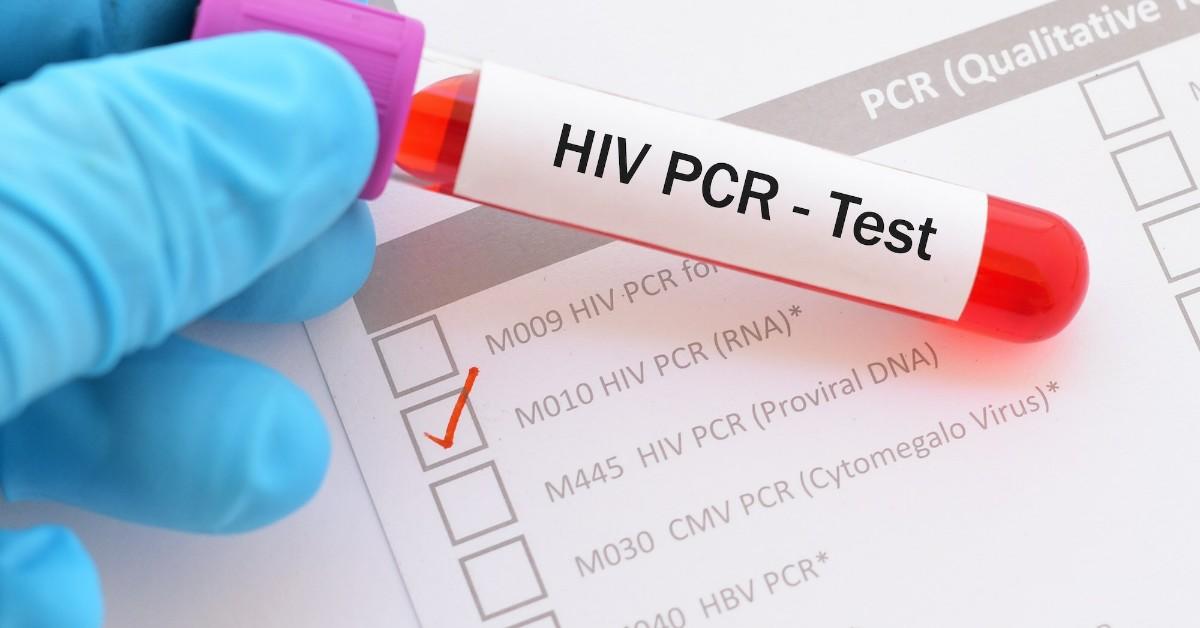 HIV PCR Test Results