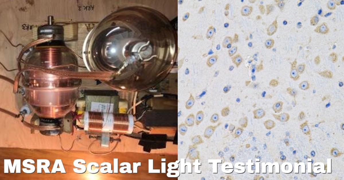 MSRA and Scalar Light Pathogenic Cleanse