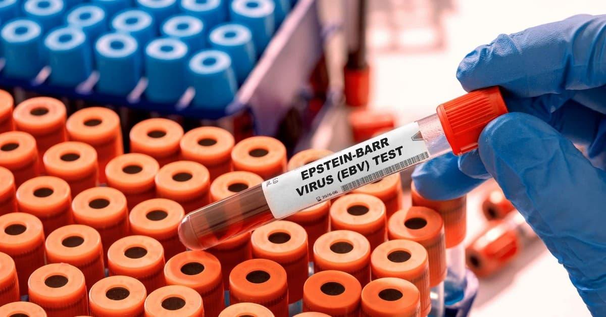 Epstein-Barr Virus PCR Tests