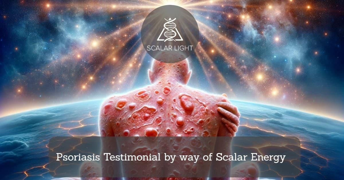 Psoriasis Testimonial by way of Scalar Energy