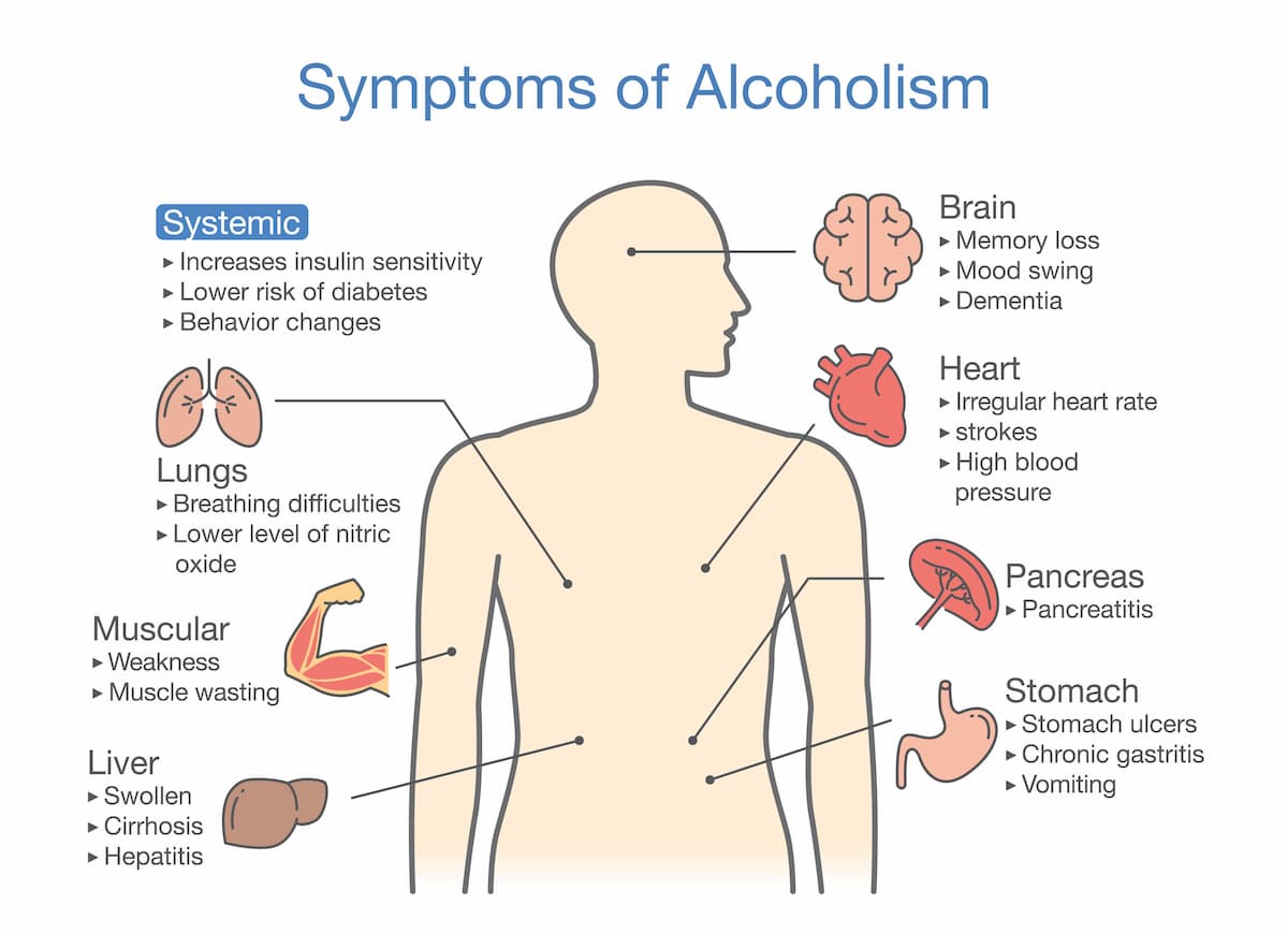 Symptoms of Alcoholism Infographic