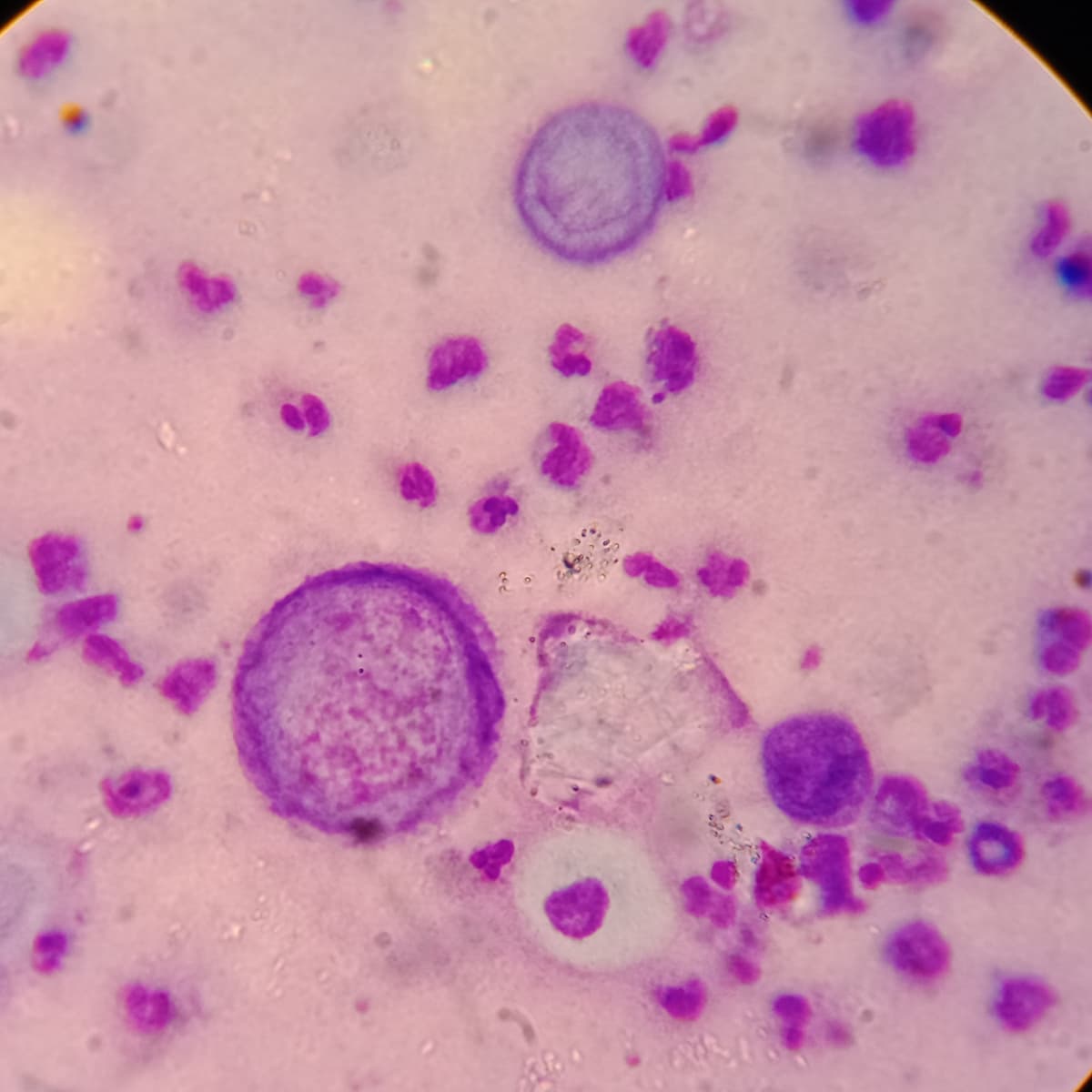 Herpes Simplex under microscope