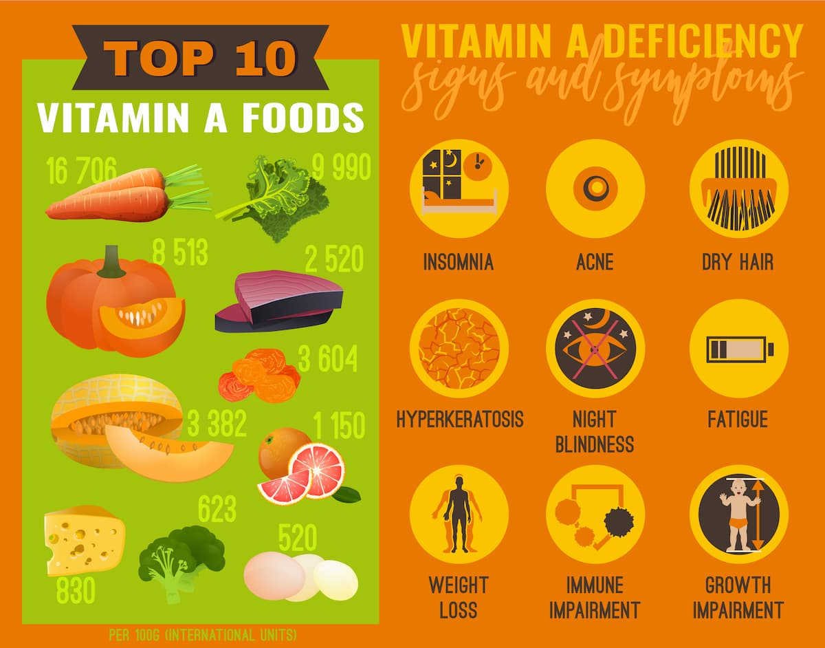 Vitamin A deficiency infographic
