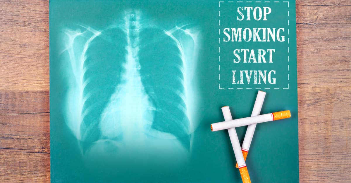 The words stop smoking start living on a chest x-ray and cigarettes on a wooden background