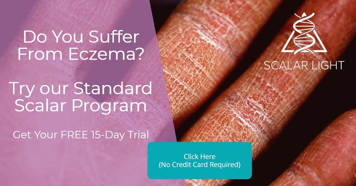 Do you suffer from Eczema?