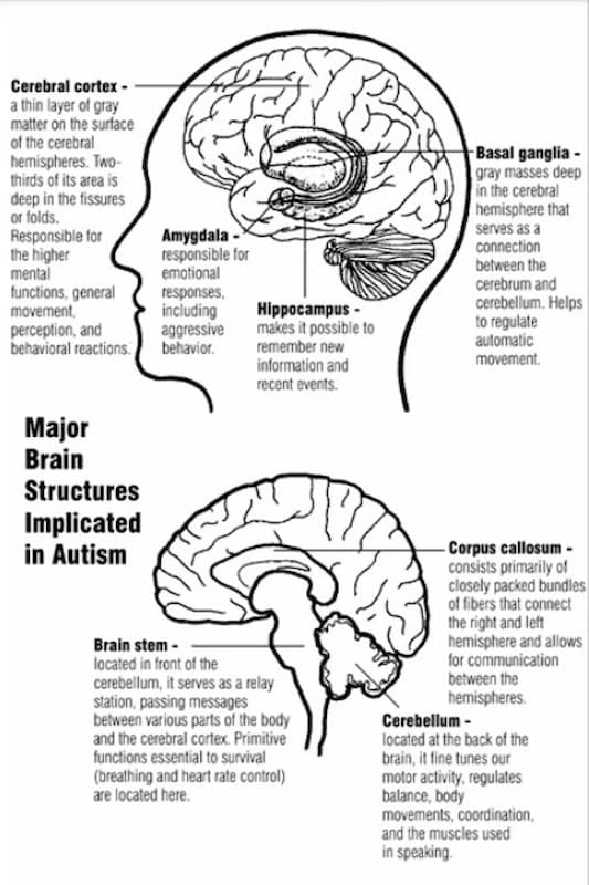 Informational diagram of the major brain structures implicated in autism