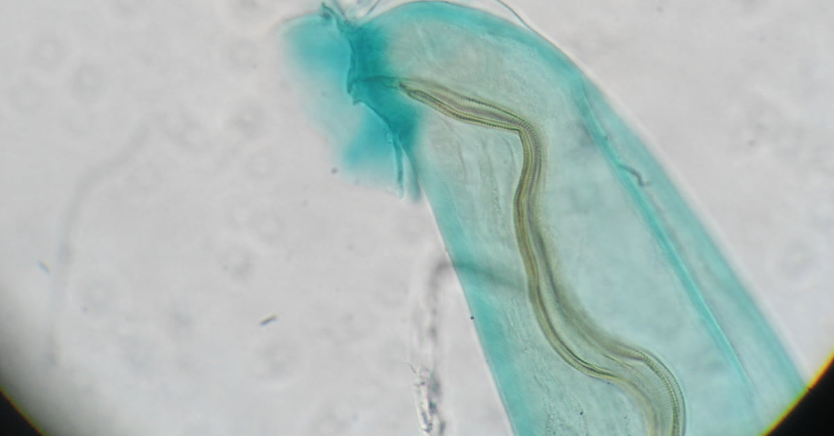 Angiostrongylus cantonensis or rat lungworm causes Eosinophilic Meningitis in humans